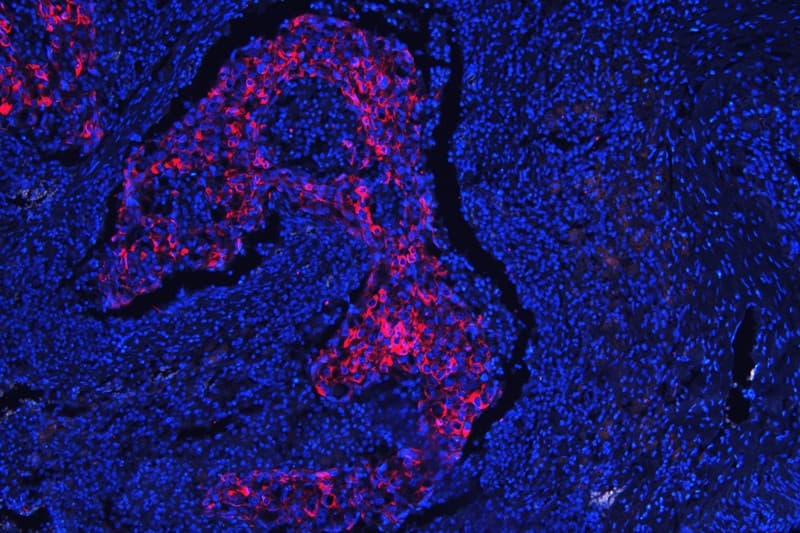 KRT18 / CK18 / Cytokeratin 18 Antibody