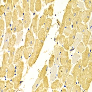 Polyclonal Rabbit anti-Human CA3 / Carbonic Anhydrase III Antibody (IHC, IF, WB)
