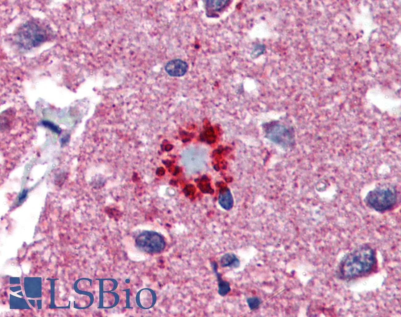 TCF21 / Epicardin Antibody (aa42-91)