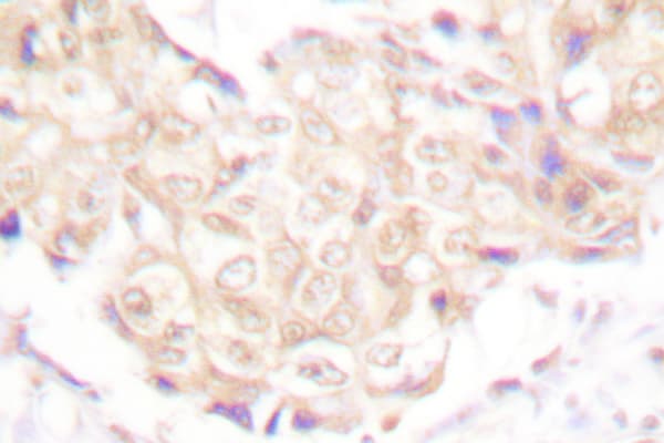 UBR5 Antibody (Thr14)