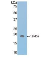 THBS1 / Thrombospondin-1 Antibody (aa515-671)
