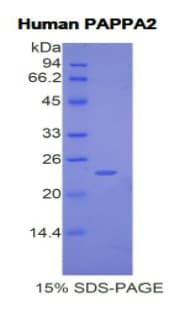 Human PAPPA2 / Pappalysin 2 Protein (Recombinant His)