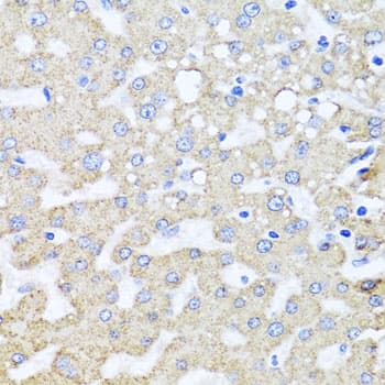 IHC-plus™ ARL6 Antibody