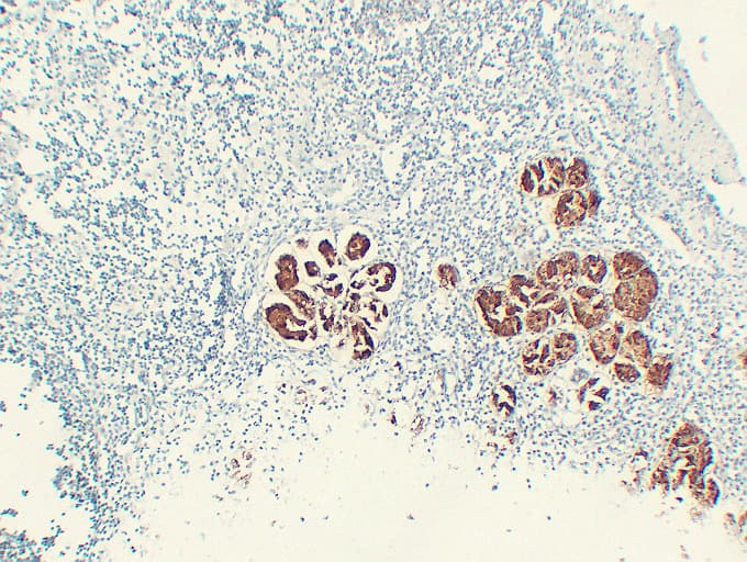 MUC6 / MUC-6 Antibody (clone ABT-MUC6)