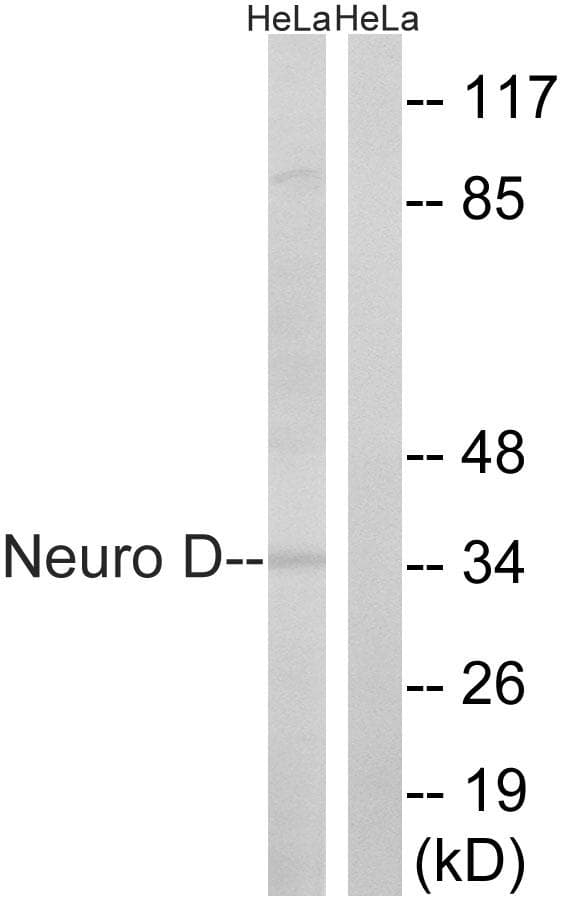 NEUROD1 Antibody (p274)