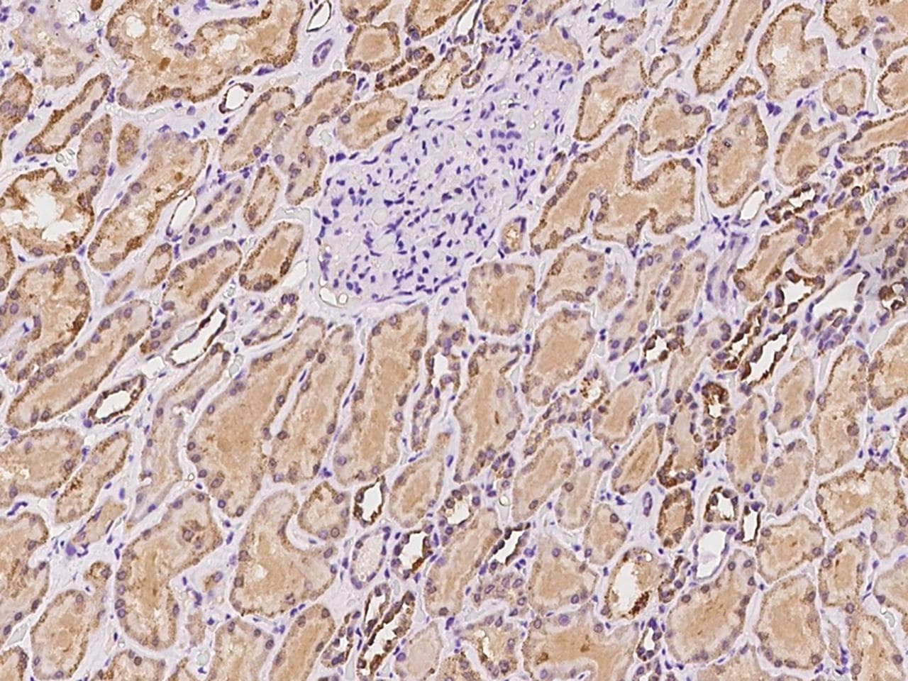 ACSS3 Antibody