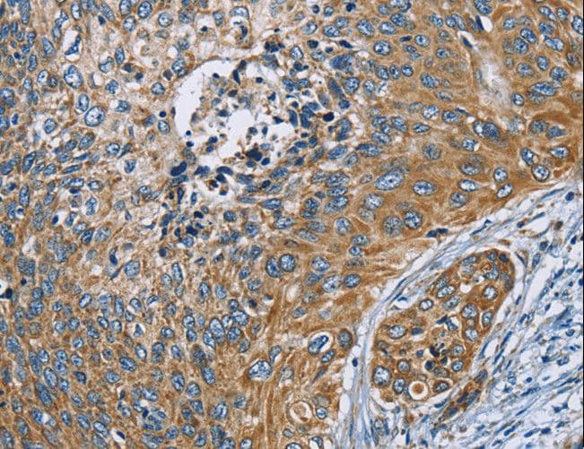ZMYND11 / BS69 Antibody