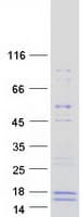 Human GALP / Alarin Protein (Recombinant Myc-DDK (Flag))