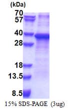 Human RPS2 / Ribosomal Protein S2 (Recombinant His)