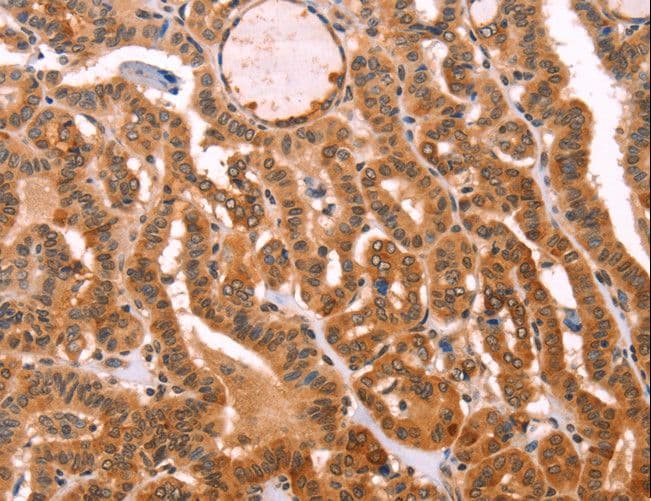 Polyclonal Rabbit anti-Human PROS1 / Protein S Antibody (IHC)