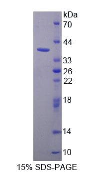 Human PURA / Pur-Alpha Protein (Recombinant His-T7)