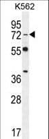 DVL3 / Dishevelled 3 Antibody (aa530-557)