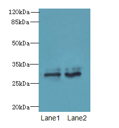 FGFR1OP2 Antibody