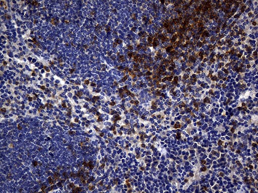 CD5 Antibody (clone UMAB9, Carrier-free)