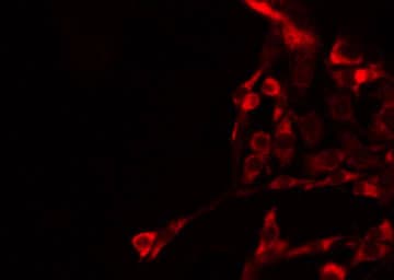 GRIA4 / GLUR4 Antibody