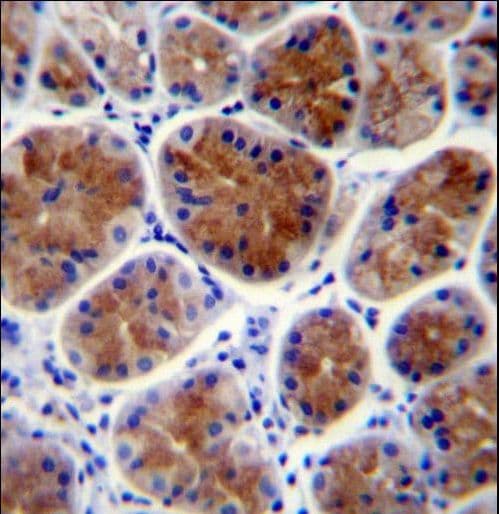 Polyclonal Rabbit anti-Human CRTR1 / TFCP2L1 Antibody (aa222-251, IHC, WB)