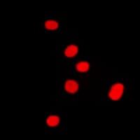 DLX5 Antibody (Internal)