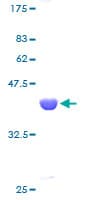 Human UBE2A Protein (Recombinant GST)
