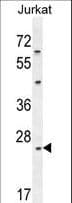 CLDN22 / Claudin 22 Antibody (aa90-117)