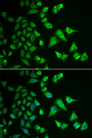 DHRS2 / HEP27 Antibody