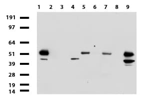 ABAT Antibody (aa29-323, clone UMAB180)