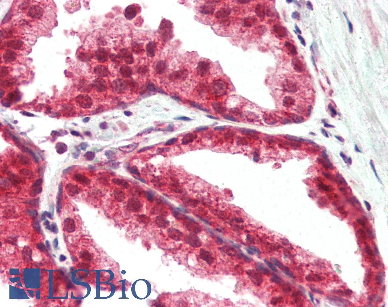 Polyclonal Rabbit anti-Human TSLP Antibody (IHC, IF, WB)