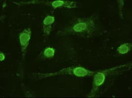 IL6 / Interleukin 6 Antibody (clone OTI3G9)