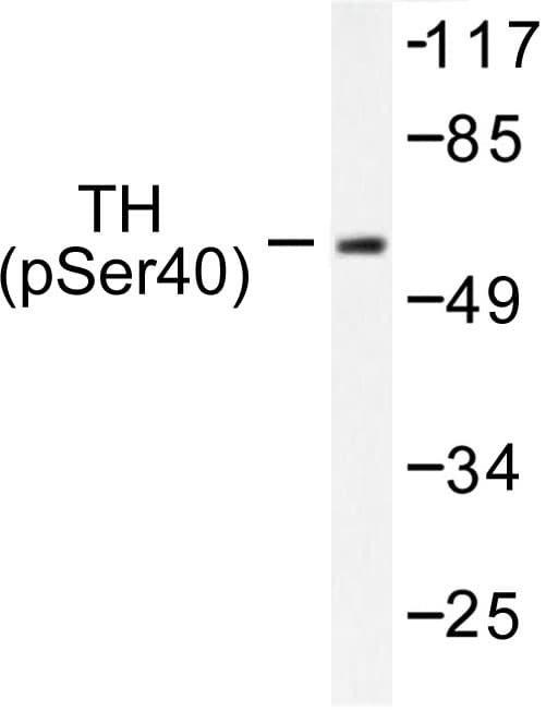 TH / Tyrosine Hydroxylase Antibody (phospho-Ser71)