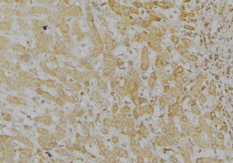 Polyclonal Rabbit anti-Human LONP1 / LON Antibody (IHC, IF, WB)