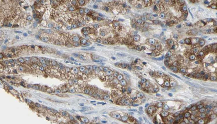IFT22 / RABL5 Antibody