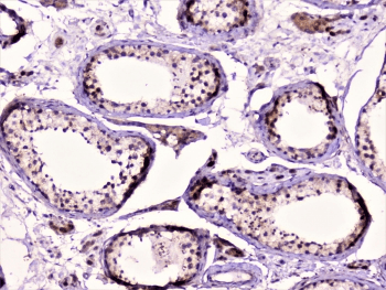 RAD51 / RECA Antibody