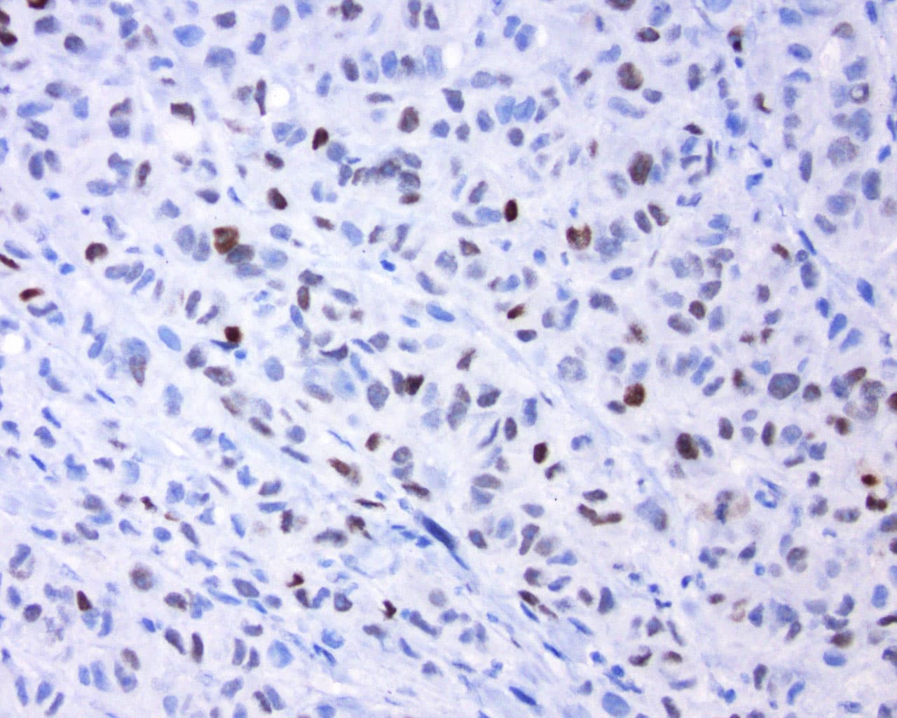 FOS / c-FOS Antibody (clone UMAB221)