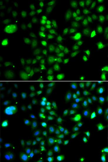 PRDM5 Antibody
