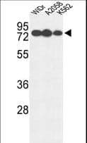 GUSB / Beta Glucuronidase Antibody (aa335-362)
