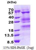 Human TADA3 / ADA3 Protein (Recombinant His)