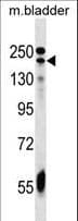 Polyclonal Rabbit anti-Human ADCY9 / Adenylate Cyclase 9 Antibody (aa1295-1323, WB)