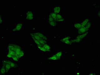 Polyclonal Rabbit anti-Human MAPK14 / p38 Antibody (IHC, IF)