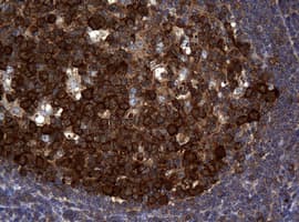 NME1 / NM23 Antibody (clone OTI4G3, Carrier-free)