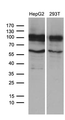GLS2 / Glutaminase 2 Antibody (clone OTI4C10)