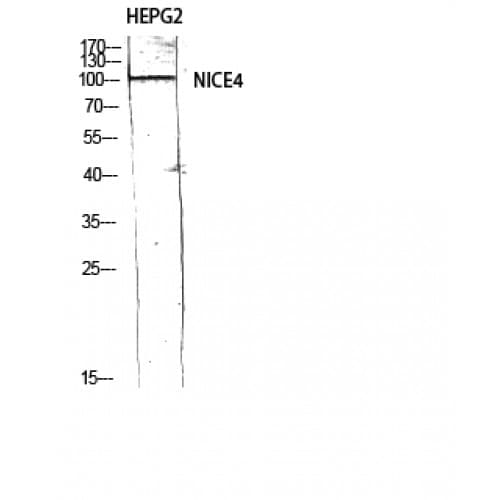 UBAP2L Antibody (530-610 aa, Internal)