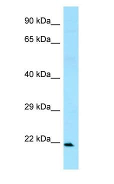 Polyclonal Rabbit anti-Human FCAR / CD89 Antibody (C-Terminus, WB)