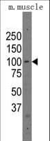 PARP12 Antibody (aa454-483)