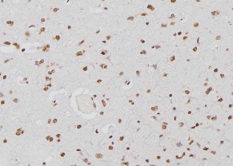 PSMA3 Antibody