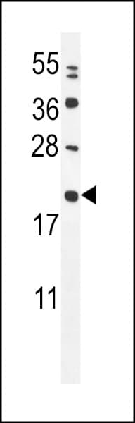 Polyclonal Rabbit anti-Human MIA40 / CHCHD4 Antibody (aa101-129, IHC, WB)