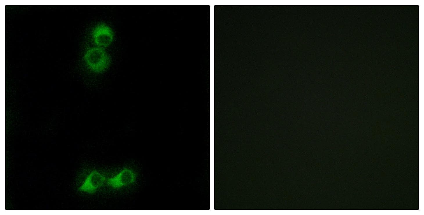 OR10J5 Antibody