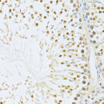 Polyclonal Rabbit anti-Human AKT1 Antibody (IHC, IF, WB)