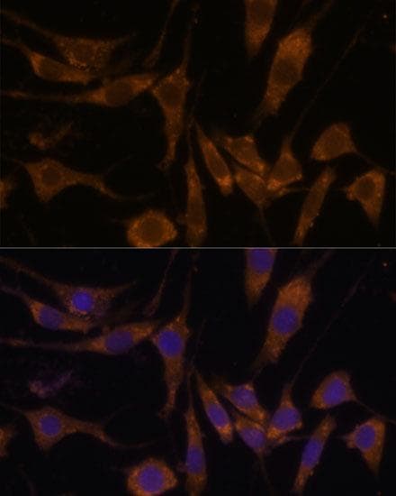 STAR Antibody