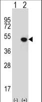 KDM8 / JMJD5 / FLJ13798 Antibody (aa36-63)