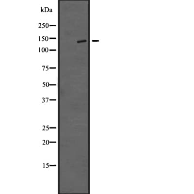 TTBK1 Antibody