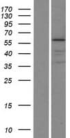 KRT75 / Keratin 75 / K6HF Protein (Over-Expression Lysate Myc-DDK (Flag))